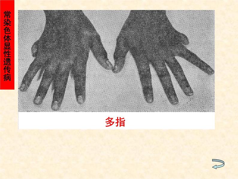 高中人教版生物必修2教学课件:5.3 人类遗传病2 Word版含答案07
