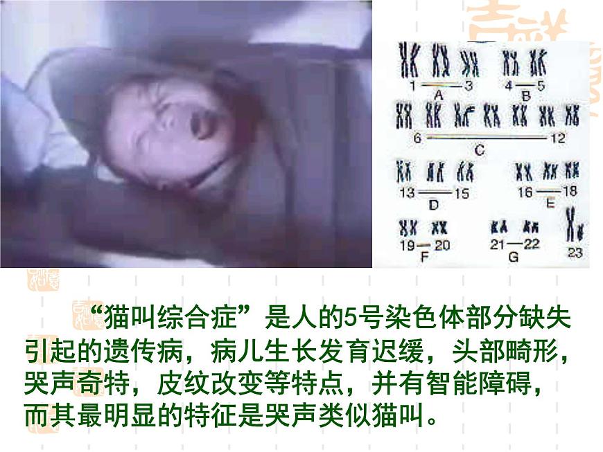 高中人教版生物必修2教學(xué)課件:5.2 染色體變異1 Word版含答案第5頁