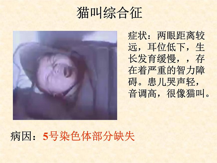 高中人教版生物必修2教學(xué)課件：5.2 染色體變異2 word版含答案第2頁(yè)