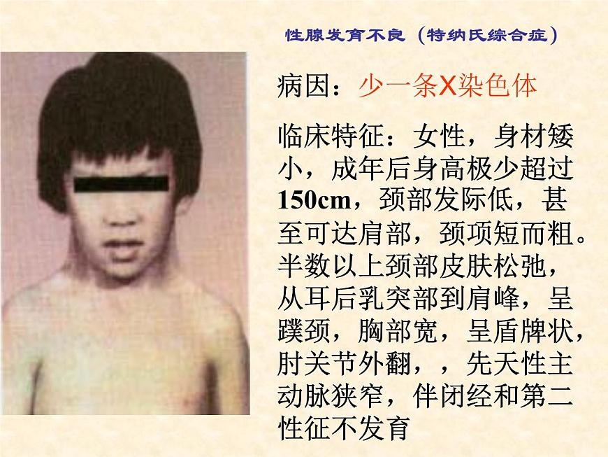 高中人教版生物必修2教學(xué)課件：5.2 染色體變異2 word版含答案第4頁(yè)