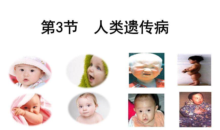 高中生物人教版 (新課標(biāo)) 必修2課件 5.3 人類遺傳?。?）第1頁(yè)