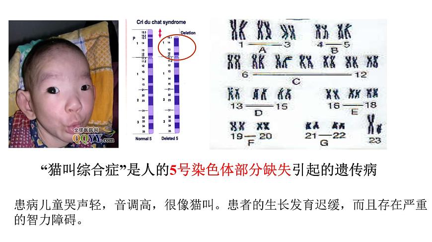 高中生物人教版 (新課標(biāo))必修2課件 5.2 染色體變異（1）第4頁