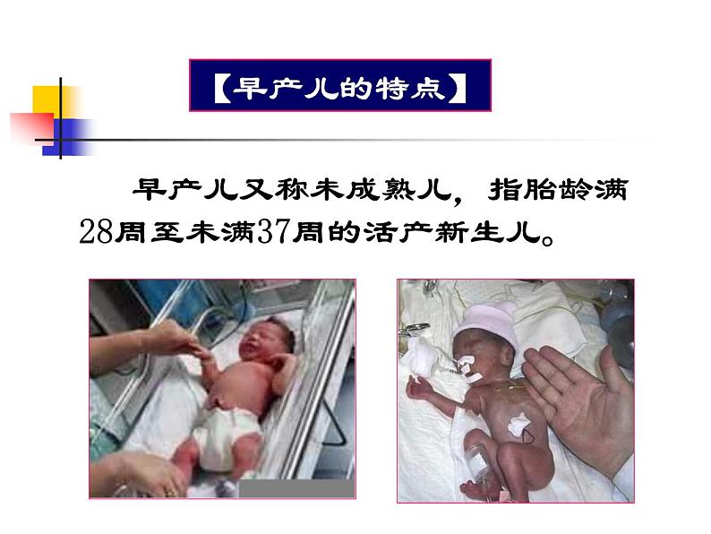 《儿科护理》第5章 第3节 早产儿的特点及护理 课件05