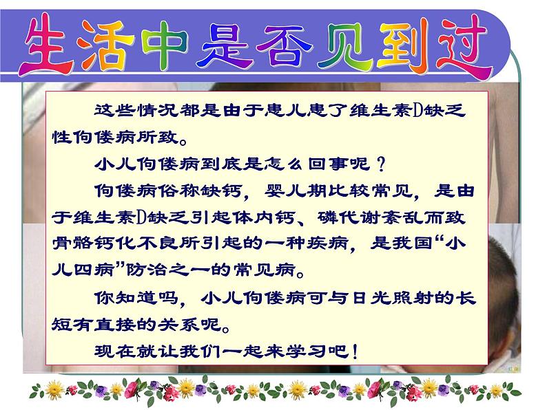 《儿科护理》第7章 第2节 维生素D缺乏性佝偻病患儿的护理 课件05