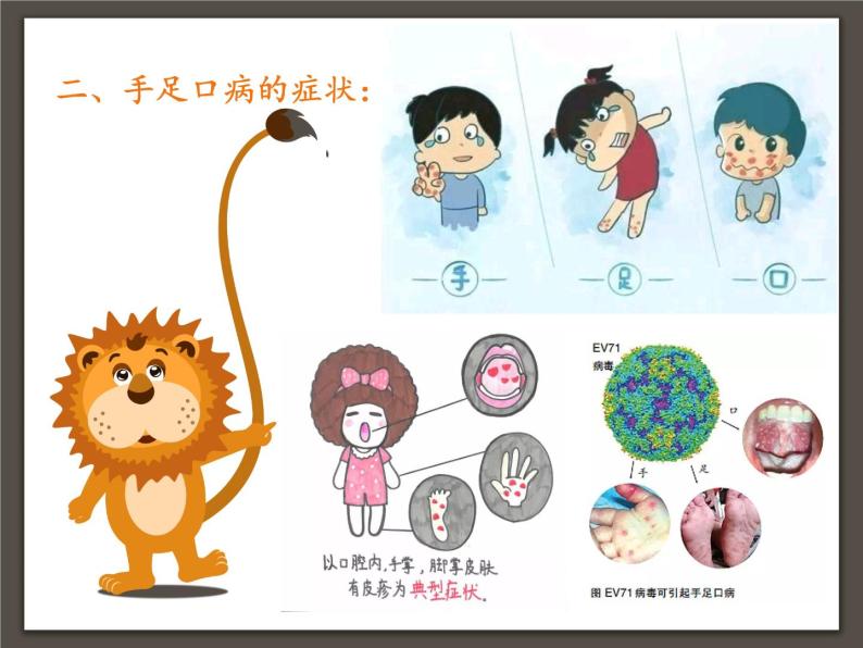 中班健康手足口病要预防ppt课件教案课后反思