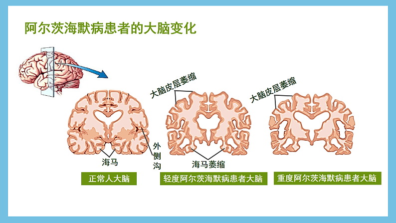 人教版高二生物选择性必修一 2.5 《人脑的高级功能》课件05
