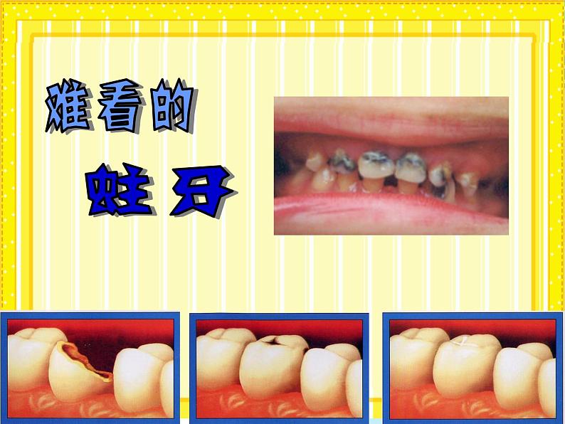 一年级上册美术课件 18牙蛀了 沪教版04