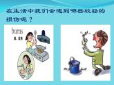3.2 轻度损伤的自我处理 （课件） 体育与健康五年级上册  人教版 (12张PPT)