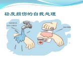 3.2 轻度损伤的自我处理 （课件） 体育与健康五年级上册  人教版 (12张PPT)