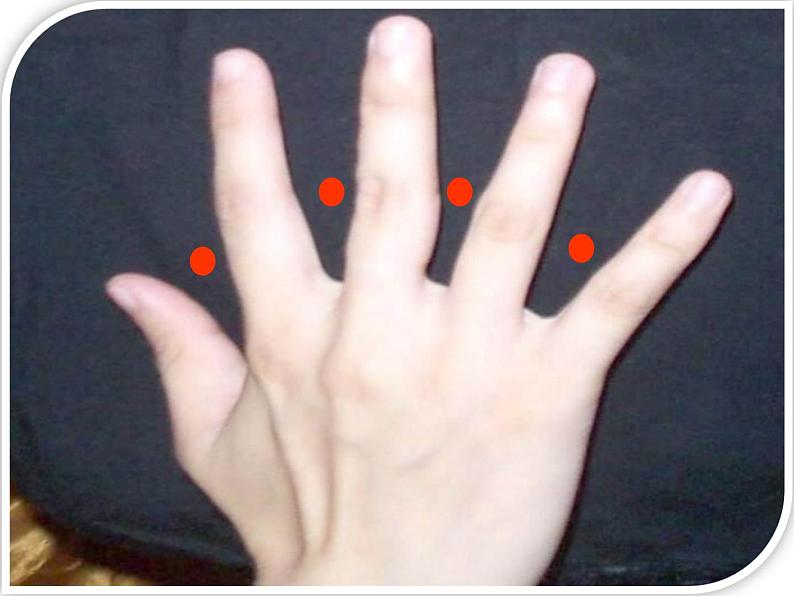 人教版五年级数学上册第七章第一节《植树问题》课件第5页