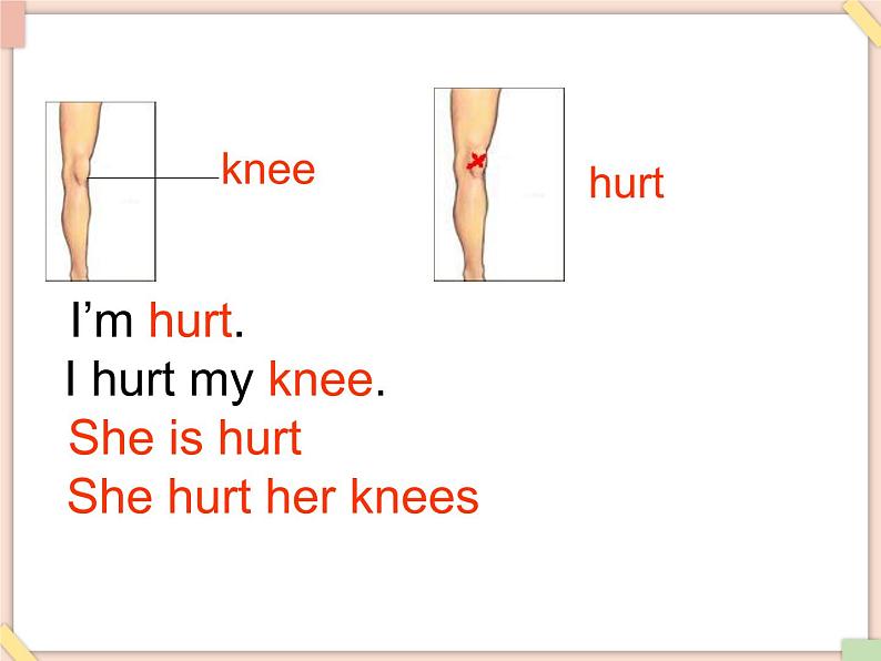 Unit 5 I Hurt my knee. 课件07