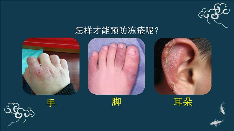 一年级道德与法治上册课件-14健康过冬天（2） 部编版07