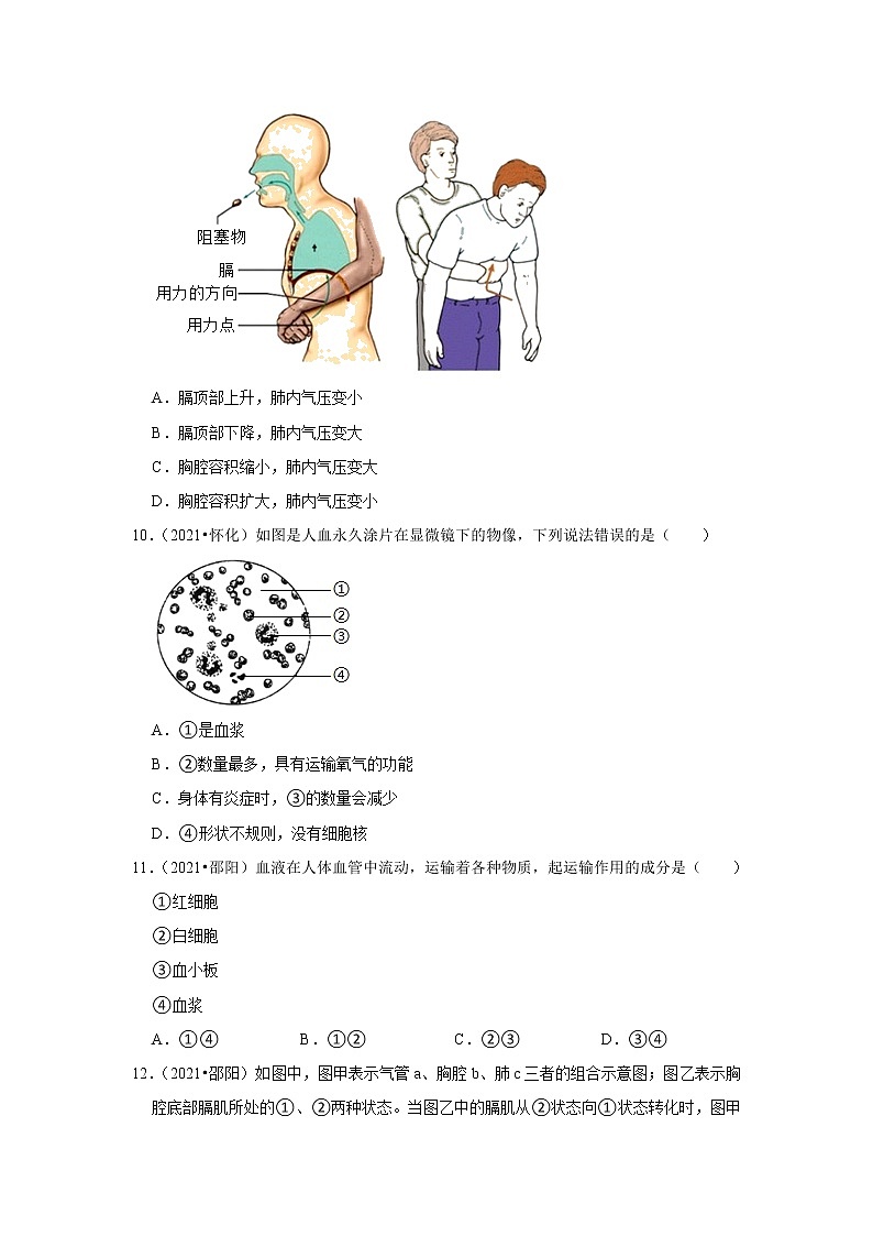 （word版附解析）人体的血液循环系统——2021年全国中考生物试题分类汇编第3页