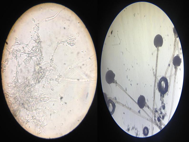 冀教版八上生物 5.2.1酵母菌和霉菌 课件06