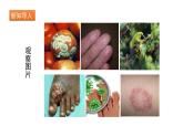 人教版八年级生物上册5.4.5人类对细菌和真菌的利用 课件