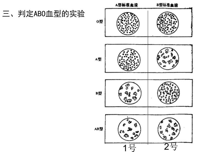 人教版生物七年级下册课件4.4 输血与血型 (1)06