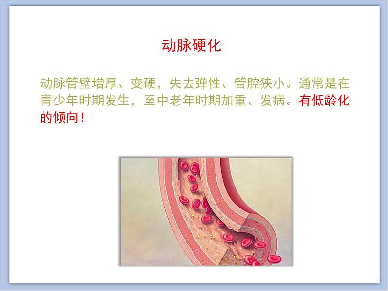 《关注心血管健康》课件+素材08