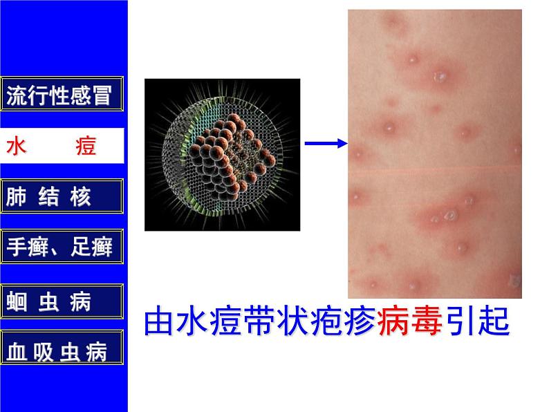 疾病与预防PPT课件免费下载07