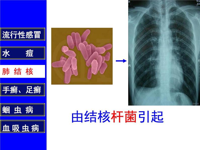 疾病与预防PPT课件免费下载08