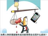 第七章第二节《尿液的形成和排出》 课件