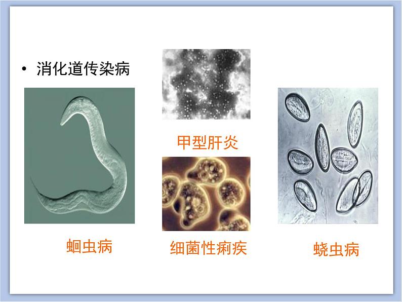 第一节 传染病 课件PPT06