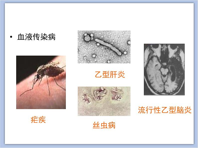 第一节 传染病 课件PPT07