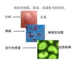 上海版八年级上册生物课件 3.2.1 常见传染病及其预防 (共28张PPT)