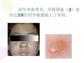 上海版八年级上册生物  3.2.2 人体的免疫功能 课件   (共32张PPT)