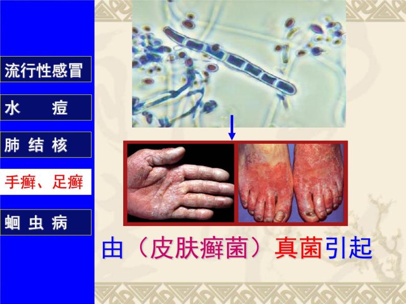 上海版八年级上册生物  3.2.1 常见传染病及其预防 课件   (共37张PPT)08
