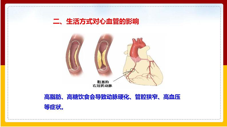 第3章 人体内的物质运输 第4节 关注心血管健康课件PPT08