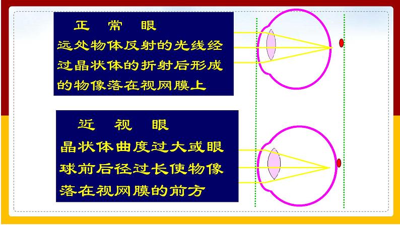 第5章 人体生命活动的调节 第4节 人体对周围世界的感知课件PPT07