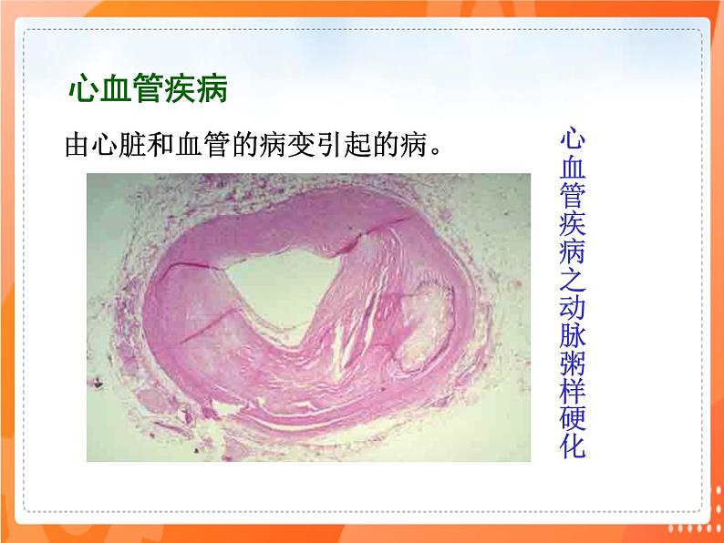 七生下 北师大版 课件13.4 当代主要疾病和预防06