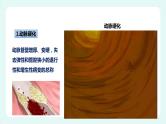 13.4 当代主要疾病和预防（课件+教案+练习+学案）