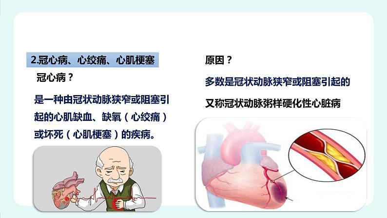 13.4 当代主要疾病和预防-课件第6页