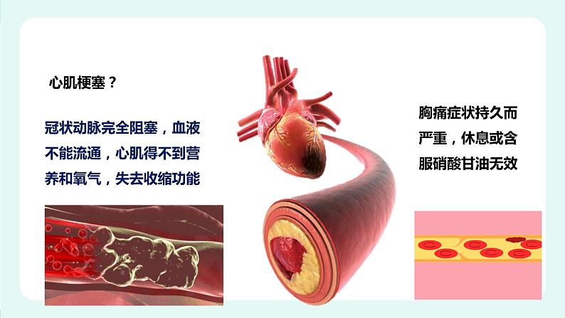 13.4 当代主要疾病和预防-课件第8页