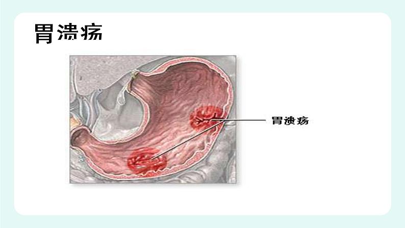 8.2食物的消化和营养物质的吸收（2）（课件+教案+练习+学案）05