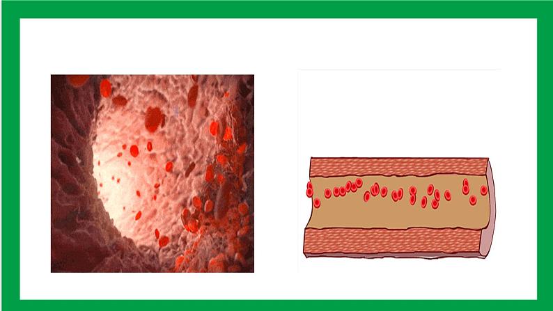4.4.2血流的管道——血管 课件第2页