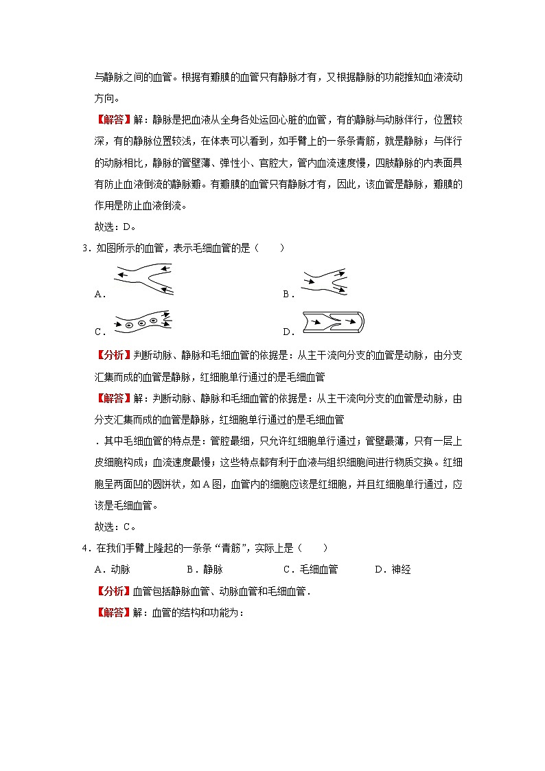考点23 血管（解析版）-2022年生物中考一轮复习考点透析（人教版）第3页