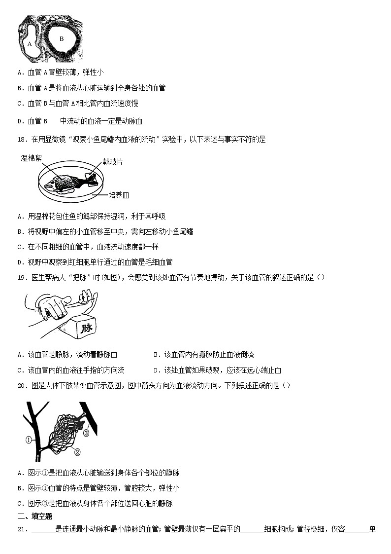 七年级生物下册4.4.2血流的管道__血管课后练习新人教版03