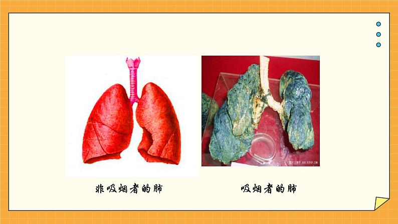 2.3 呼吸保健和急救 课件第8页