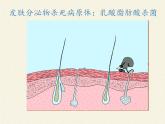 北师大版生物七年级下册 第13章 第3节 人体免疫(14)（课件）