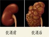 北师大版生物七年级下册 第13章 第1节 健康及其条件(20)（课件）