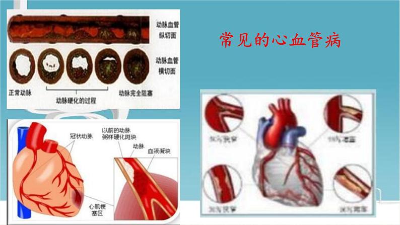 北师大版生物七年级下册 第13章 第4节 当代主要疾病和预防(4)（课件）05