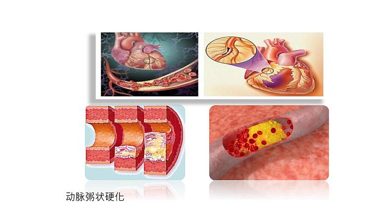 北师大版生物七年级下册第十三章《健康地生活》13.4 当代主要疾病和预防  PPT教学课件05