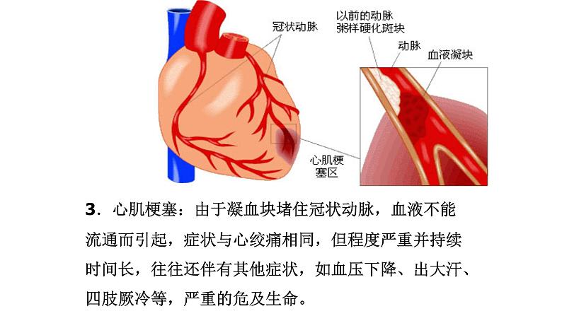 北师大版生物七年级下册第十三章《健康地生活》13.4 当代主要疾病和预防  PPT教学课件07