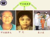 苏教版生物七年级下册 第十二章 第一节 人体的激素调节(21)（课件）