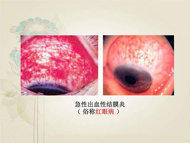 初中生物人教版八年级下册 第一节传染病及其预防 3 课件第2页