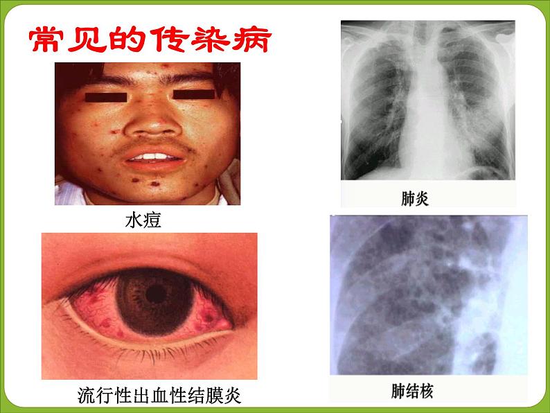 初中生物人教版八年级下册 第一节传染病及其预防 6 课件第8页