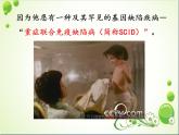 初中生物人教版八年级下册 第二节免疫与计划免疫 4 课件