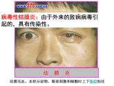 初中生物人教版八年级下册 第一节传染病及其预防 7 课件